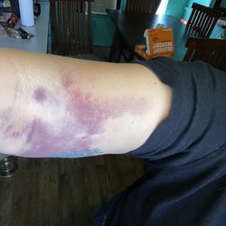 KEDPLASMA San Antonio