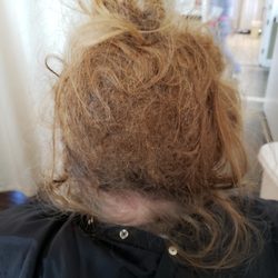New Orange Hills - The back of patient's hair.  It was 2 feet long but snarled up in a wad.