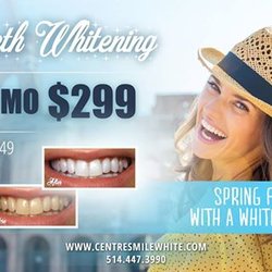 Centre Smile White