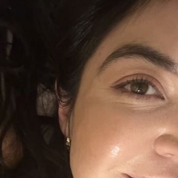 Zavant Aesthetics - After v-beam with makeup - Laser Hair Removal Near Me - West Hollywood, California