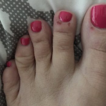 1 Epic Nails & Spa - This was the sores that the owner Tony caused by buffing my toes so hard that they bleed. Definitely don't recommend this nail salon. - Nail Salons Near Me - Gilbert, Arizona 1 Epic Nails & Spa - This was the sores that the owner Tony caused by buffing my toes so hard that they bleed. Definitely don't recommend this nail salon. - Nail Salons Near Me - Gilbert, Arizona
