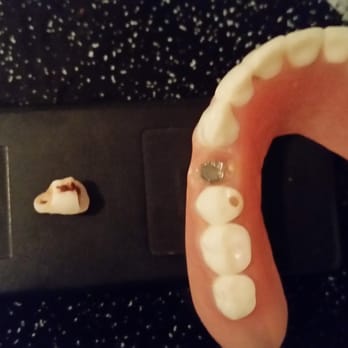 The Perio Group - Dr. Steven Brown need to sever his ties with Dr. Paul Berson, had it not been for him sending me to Dr. Berson, I would not be out  $14,400. - Periodontists Near Me - Philadelphia, Pennsylvania