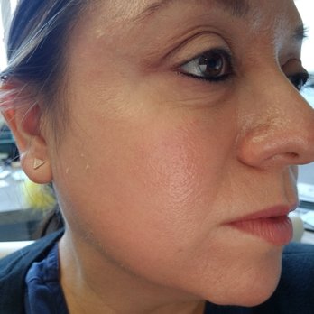 Beverly Hills Skincare Muse - Thank you for making me love my skin again. - Skin Care Near Me - Beverly Hills, California