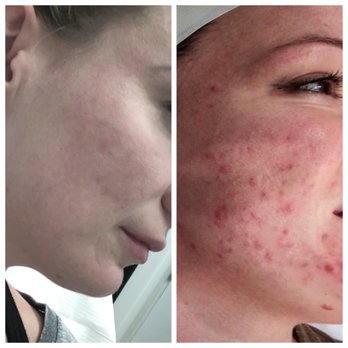 Long Harris Dermatology - Dermatologists Near Me - Lubbock, Texas Long Harris Dermatology - Dermatologists Near Me - Lubbock, Texas