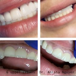 Anisha Nguyen, DDS - Mile Square Park Family Dental Group - Naturally Beautiful#BeverelyHillsmile