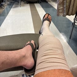 Michael Gustavel - Gustavel Orthopedics - Right after surgery.