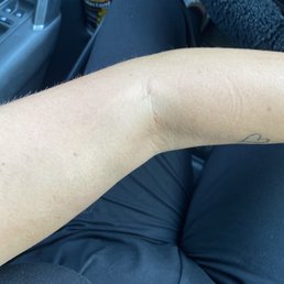 Terrible spray tan Terrible spray tan