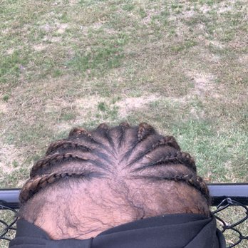 Ultimate Braiding - Braids TOO TIGHT !!!!! - Hair Extensions Near Me - Woodlawn, Maryland Ultimate Braiding - Braids TOO TIGHT !!!!! - Hair Extensions Near Me - Woodlawn, Maryland