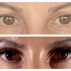 Rohit Jaiswal, MD - Atelier Plastic Surgery
