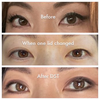 Dr. Kenneth Kim Plastic Surgery - Plastic Surgeons Near Me - Los Angeles, California Dr. Kenneth Kim Plastic Surgery - Plastic Surgeons Near Me - Los Angeles, California