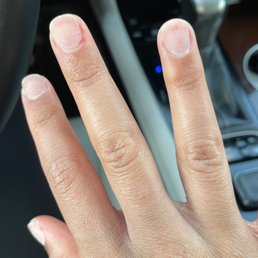 Just one of three fingers they made bleed