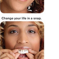 Park Family Dental - Snap on Smile - affordable, non- invasiv, completely reversible, cosmetic, removable appliance for beautiful smile.