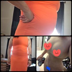 Mia Aesthetics Chicago - Me veia como el vestido naranja y me dejaron como la foto