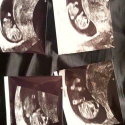 Corbella Clinic - Ultrasound