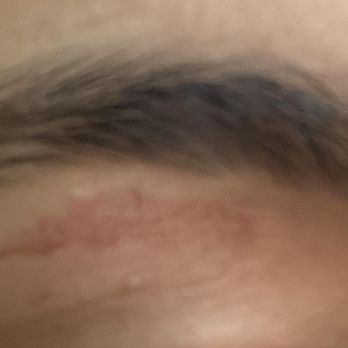 Mona Beauty Salon - eyebrow wax was too hot and left a burn on my skin - Skin Care Near Me - Fremont, California Mona Beauty Salon - eyebrow wax was too hot and left a burn on my skin - Skin Care Near Me - Fremont, California