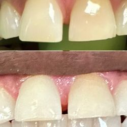 Retro Smile - My husband's before and after photos. This was the first session