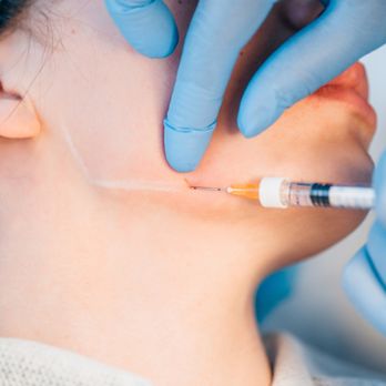 Radiant Med Spa - chiseled jawline - Laser Hair Removal Near Me - Fremont, California Radiant Med Spa - chiseled jawline - Laser Hair Removal Near Me - Fremont, California