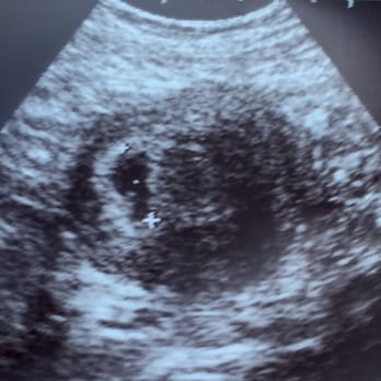Regina Edmond, MD - From another clinic happy to confirm my second pregnancy - Obstetricians & Gynecologists Near Me