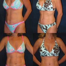 Miller Cosmetic Surgery Center - Scott R. Miller, MD, FACS