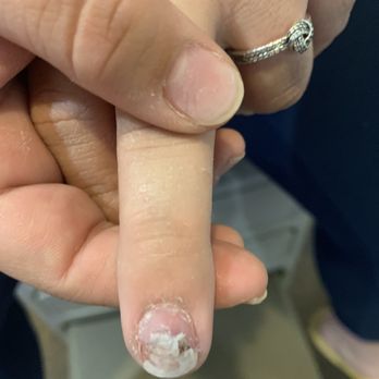 Visible Nails - Here's my broken nail that they did - Nail Salons Near Me - Millersville, Pennsylvania Visible Nails - Here's my broken nail that they did - Nail Salons Near Me - Millersville, Pennsylvania