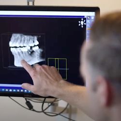 Wood River Dental Care - Wood River Dental veneers