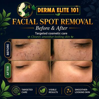 Derma Elite 101 - Skin Care Near Me - Las Vegas, Nevada