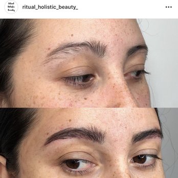 Ritual - Before and After - First Session - Skin Care Near Me - Corrales, New Mexico