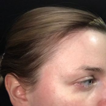 Self Image Salon - I'm balding on the sides now. Do you see how thin my hair is now?!?! - Hair Salons Near Me - Amityville, New York Self Image Salon - I'm balding on the sides now. Do you see how thin my hair is now?!?! - Hair Salons Near Me - Amityville, New York