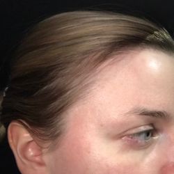 Self Image Salon - I'm balding on the sides now. Do you see how thin my hair is now?!?!