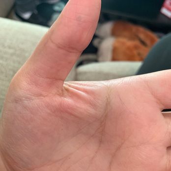 American Nail & Spa - She left me a bruise - Nail Salons Near Me - Fontana, California
