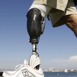 Performance Prosthetics & Orthotics