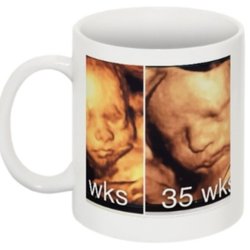 My Baby's First Images