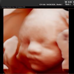 MOMents 4D/5D Baby Ultrasound