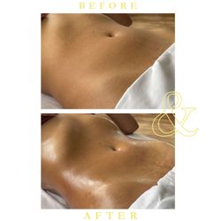 Full body Brazilian lymphatic drainage massage