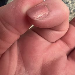 Sloppy polish - part of nail with no polish. Sloppy polish - part of nail with no polish.