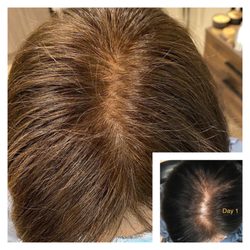 Wisp Organic Salon - Before/after hair loss treatments