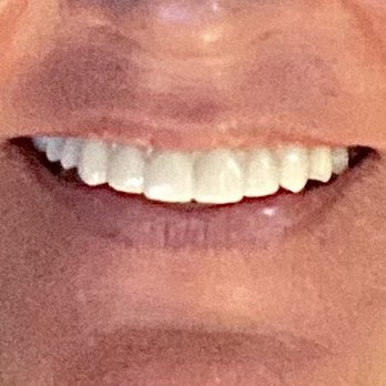 Advanced Dentistry - General Dentistry Near Me - Lewisville, Texas