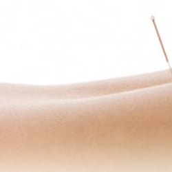 Oak Hill Family Chiropractic Clinic-Dr. Barry Stowers, DC-Fiama