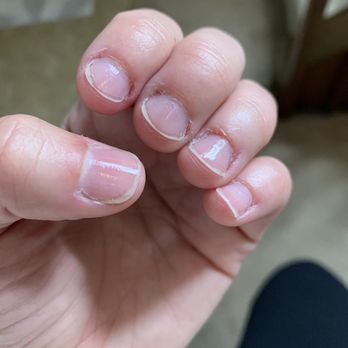 Serenity Spa & Nails - Cuticles not cleaned up well, dry because of no oil added after. - Nail Salons Near Me - Bossier City, Louisiana