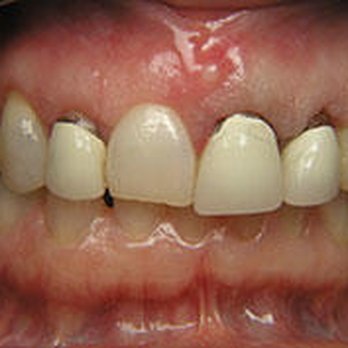 Christopher Poss, DDS - Cosmetic Dentists Near Me - Eau Claire, Wisconsin Christopher Poss, DDS - Cosmetic Dentists Near Me - Eau Claire, Wisconsin