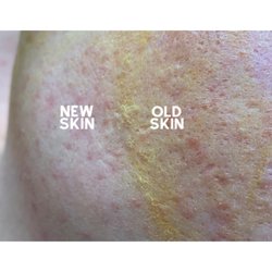 The Palace Aesthetics - Dermaplaning facial