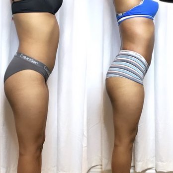Bella Body Treatments - These are my 2 week results from BellaBodyTreatments!! - Weight Loss Centers Near Me - Riverside, California Bella Body Treatments - These are my 2 week results from BellaBodyTreatments!! - Weight Loss Centers Near Me - Riverside, California