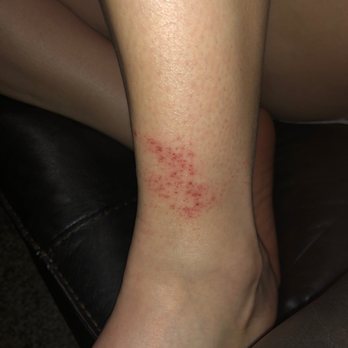 CA Nails - This is 24 hours later. - Nail Salons Near Me - Lubbock, Texas CA Nails - This is 24 hours later. - Nail Salons Near Me - Lubbock, Texas
