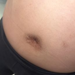 Her closed belly
