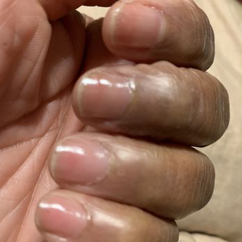 VIP Nails & Spa - Damaged pink nail Ed and new growth above it. - Nail Salons Near Me - Chicago, Illinois VIP Nails & Spa - Damaged pink nail Ed and new growth above it. - Nail Salons Near Me - Chicago, Illinois