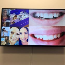 Smile Direct Club