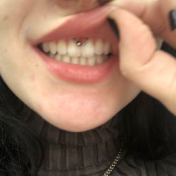Blue Magic Tattoo Studio - Smiley piercing :) - Tattoo Near Me - Bellingham, Massachusetts