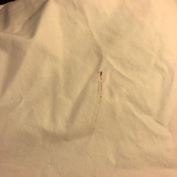 Hilton Garden Inn Amarillo - blood on pillow - Hotels Near Me - Amarillo, Texas Hilton Garden Inn Amarillo - blood on pillow - Hotels Near Me - Amarillo, Texas