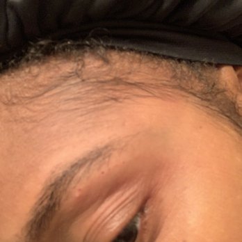 Savarnas Beauty Spa - Eyebrow nicked in 3-4 different spots along the brow. - Skin Care Near Me - Virginia Beach, Virginia Savarnas Beauty Spa - Eyebrow nicked in 3-4 different spots along the brow. - Skin Care Near Me - Virginia Beach, Virginia