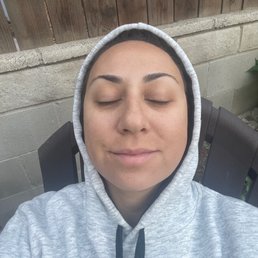 Me one day after full face threading and facial